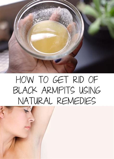 How To Get Rid Of Black Armpits Using Natural Remedies New Me 2017