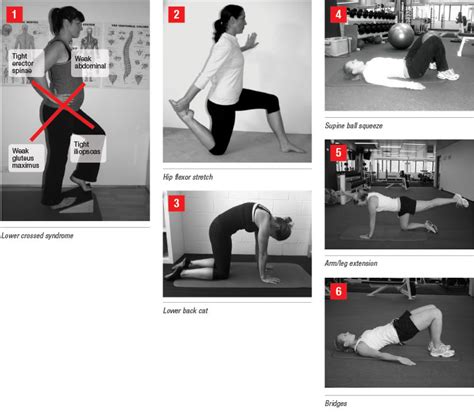 Lower Cross Syndrome Exercises Captions Save