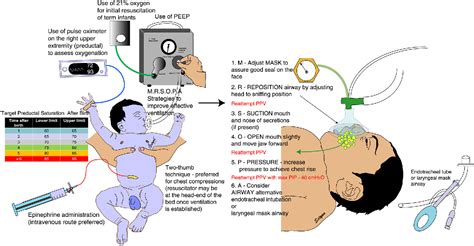 Neonatal Resuscitation Evolving Strategies Semantic Scholar