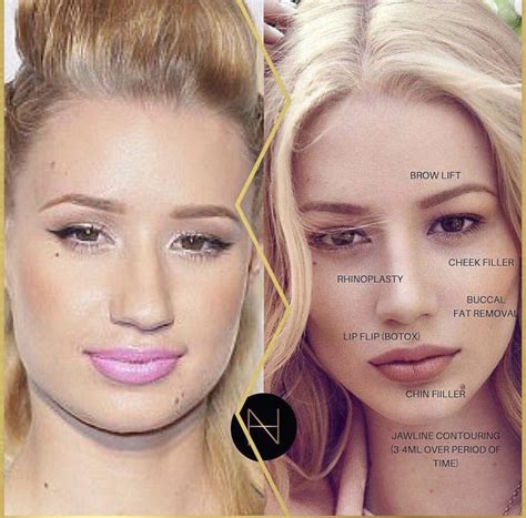 Surgery by Samantha Blue | Face plastic surgery, Plastic surgery, Celebrity plastic surgery