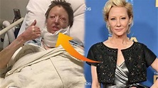 Anne Heche Hospital Video | Anne Heche Death Video | Anne Heche Dead at ...