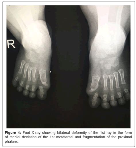 Radiology Bilateral Deformity