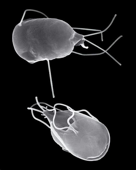 Giardia Lamblia Parasitic Protozoan Photograph By Dennis Kunkel