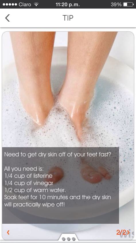 How To Get Dry Skin Off Your Feet Musely