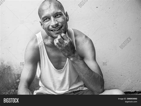 Happy Homeless Young Skinny Anorexic Bald Positive And Happy Smiling