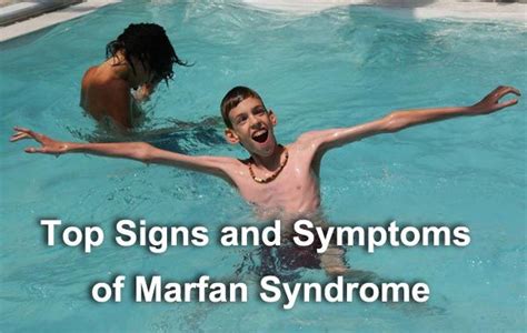 Marfan Syndrome Is A Disorder That Is Inherited Through Gene Mutations