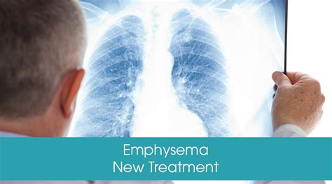 First Patient In Us Gets New Treatment For Emphysema