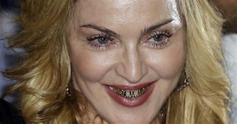 Madonna Tooth Gap Celebrities With Tooth Gaps Gaps Between Front