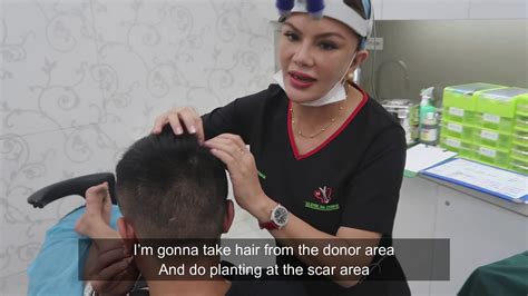 I have discovered their passion in learning malay language—and yet still unable to talk anything meaningful even after several years living in the country. SCAR REVISION BY FUE | HAIR TRANSPLANT CENTRE MALAYSIA ...