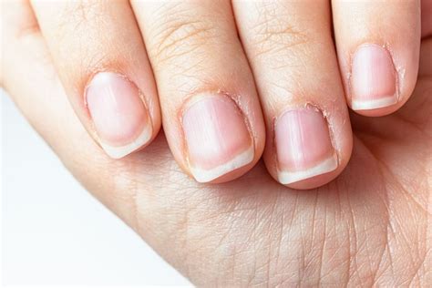 Bad Cuticles Vs Good Cuticles How To Identify