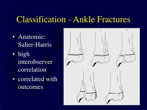 Ppt Pediatric Ankle And Foot Fractures Powerpoint Presentation Id3603149