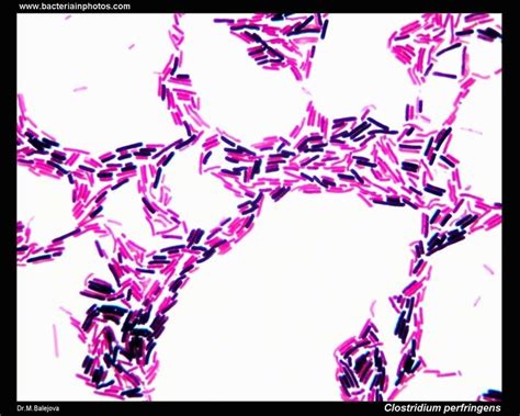 Clostridium Gram Stain Morphology