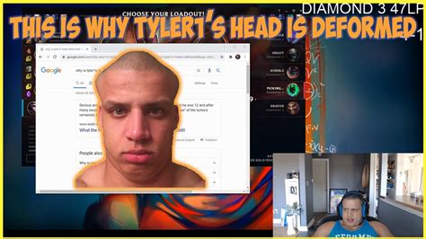 This Is Why Tyler1s Head Is Deformed Highlights 73 Youtube