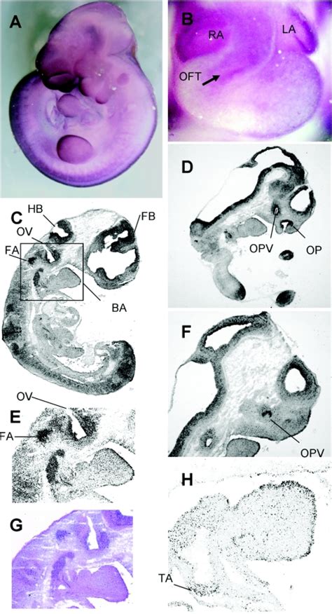 Spectrum Of Chd7 Mutations In 110 Individuals With Charge Syndrome And