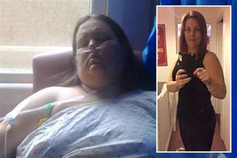 Morbidly Obese Woman Who Lost 17 Stone Says She Was Happier Fat