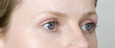 Why Itchy Eyebrows Causes And Treatment