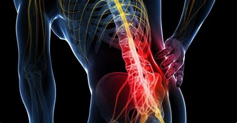 Pathophysiological Model For Chronic Low Back Pain
