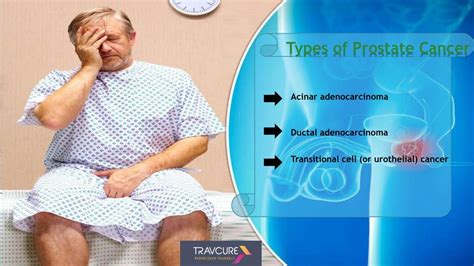 PPT Prostate Cancer Symptoms Types And Treatment PowerPoint Presentation ID