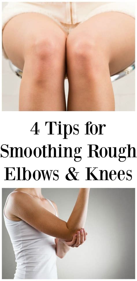 4 tips for smoothing rough elbows and knees