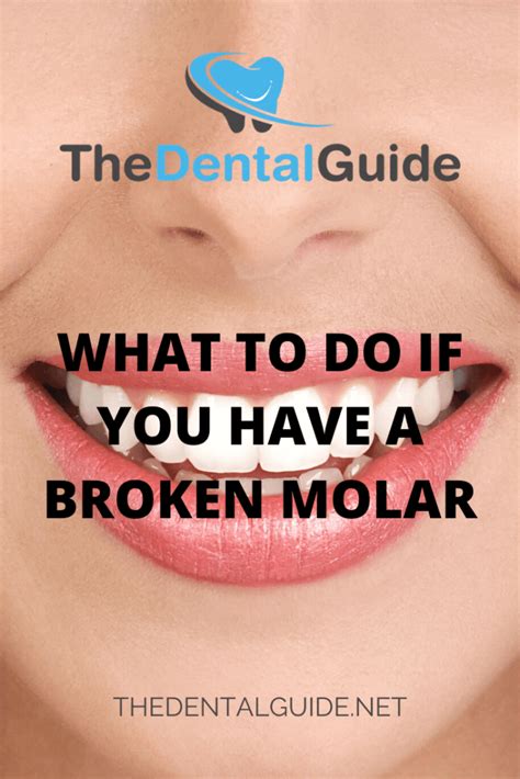 What To Do If You Have A Broken Molar The Dental Guide Usa