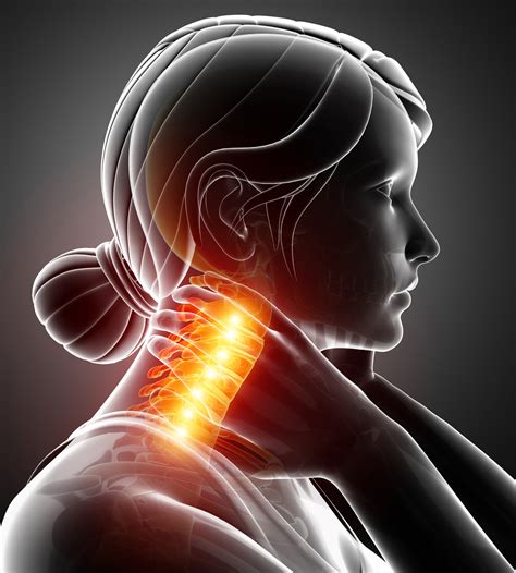 What Is Your Neck Pain Telling You New Canaan Chamber