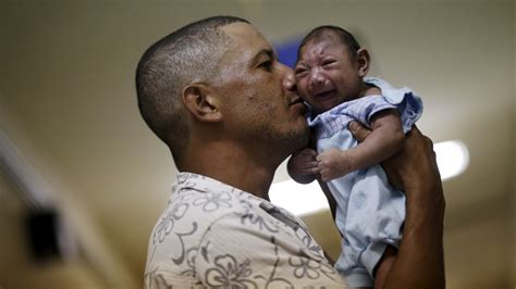 Caught Off Guard By Zika Brazil Struggles With Deformed Babies