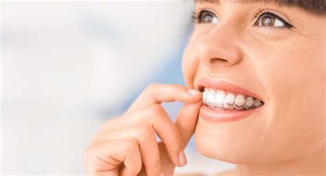 Best Options To Straighten Your Teeth Without Braces Dulwich Dental