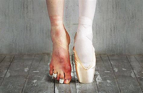 Many Ballerinas Are So Beautiful But Their Feet Imdb V2 2