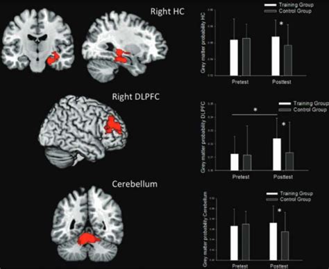 Videoame Effects On Brain Siowfa Science In Our World Certainty And Controversy