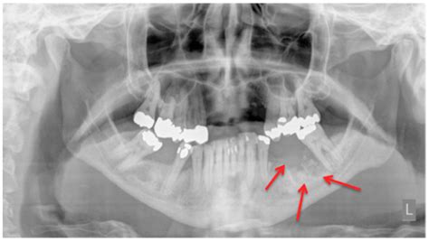 Dentistry Journal Free Full Text Imaging In Patients With