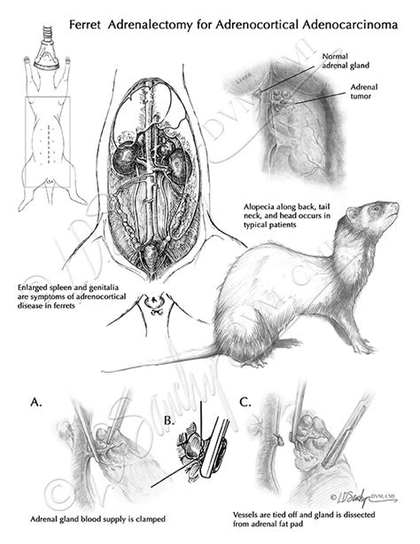 Portfolio Sawchyn Medical Illustration