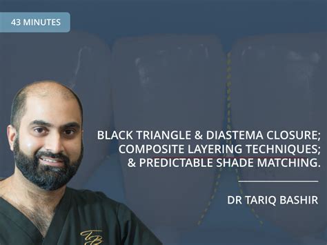 Black Triangle And Diastema Closure Composite Layering Techniques And