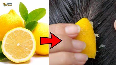 How To Use Lemon To Get Rid Of Dandruff