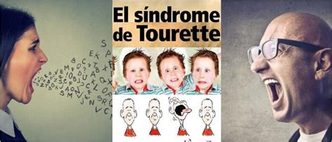 Síndrome De Tourette Clasificación Características Fisiopatología