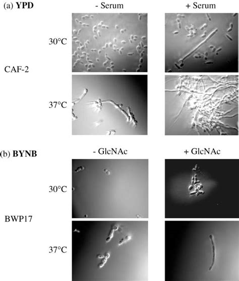 Morphology Of Candida Albicans In Hypha Inducing Conditions A Yeast