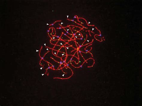 Pachytene Stage Human Oocyte Showing Multiple Synaptic Defects