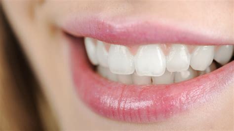 Teeth Are Becoming See Through Cosmetic Dentistry By Dentists In Leicester Smile Essential