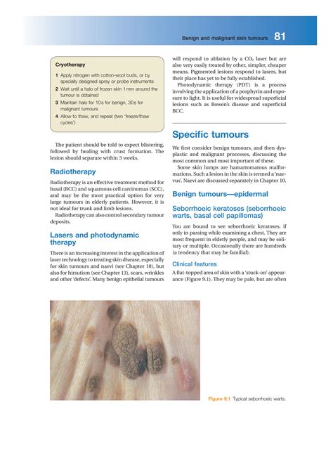 Solution Dermatology Lecture Notes Robin Graham Brown Chapter 9