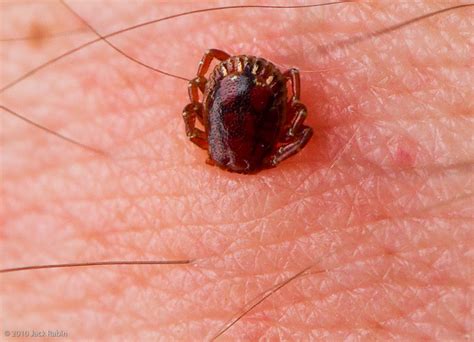 Learn about ticks and find out how to remove ticks. A Mom's Rambles: Tick Season, Safe Removal; What You Need ...