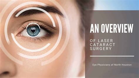 An Overview Of Laser Cataract Surgery Eye Physicians Of North Houston Ophthalmologists