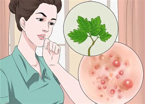 How To Get Rid Of Armpit Rash Fast Causes Treatment And Prevention