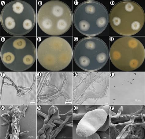 Morphological Characters Of Cladosporium Silenes Knu14 18 1 Grown For