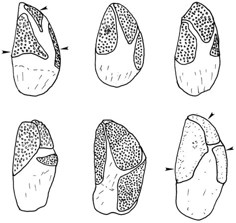 Comparison Between The Primordial Plates Of The Earliest Juvenile Download Scientific Diagram
