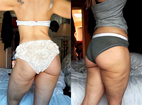 Cellulite Saturday’ Is The Instagram Trend Everyone Needs To See Glamour