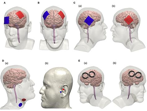 Frontiers Applications Of Non Invasive Neuromodulation For The