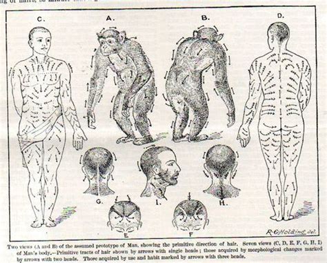 Mapping The Flow Of Human Body Hairin 1902 Hair Flow Hair Growth