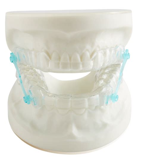 Splints And Appliances Anti Snoring Devices Anti Snoring Mouth Guard Southern Cross Dental