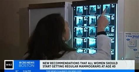 new recommendations that all women get regular mammograms starting at 40 cbs boston