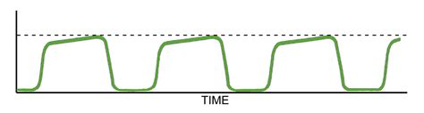 Capnography Waveform