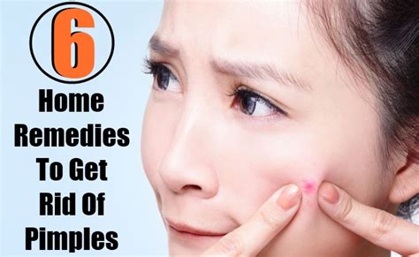 6 Best Home Remedies To Get Rid Of Pimples Lady Care Health